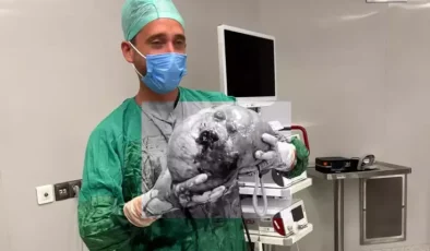 70 yaşındaki kadının karnından 40 kilogram kitle çıkarıldı